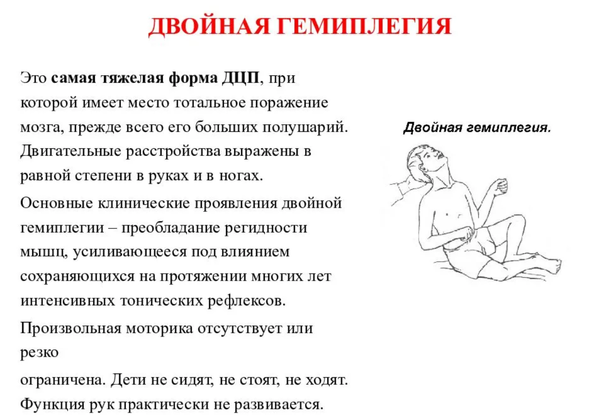 Возможности обучения при гемиплегии двойной - Формы ДЦП